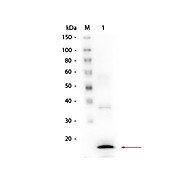 Procalcitonin [8G10.H3.C3.G4.E2]