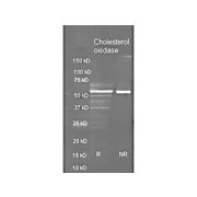Anti-CHOLESTEROL OXIDASE (Microorganism) (GOAT) Antibody