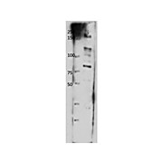 ABCB8 Antibody