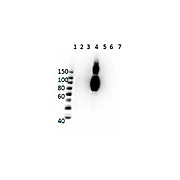 Anti-HbC (MOUSE) Monoclonal Antibody