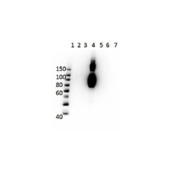 Anti-HbC (MOUSE) Monoclonal Antibody
