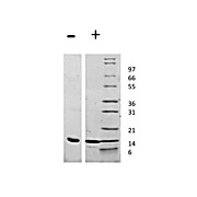 Rat Leptin Recombinant Protein