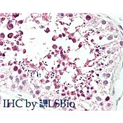 Anti-MLF1IP / PBIP1 (RABBIT) Antibody