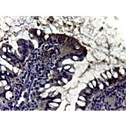 Carbonic Anhydrase II Antibody