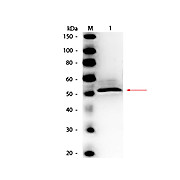 Anti-HEXOKINASE (RABBIT) Antibody Peroxidase Conjugated