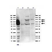 Anti-Integrin beta 3 (RABBIT) Antibody
