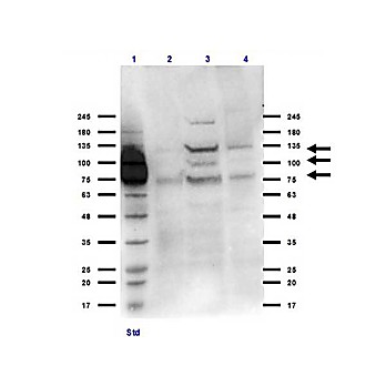 Anti-Integrin beta 3 (RABBIT) Antibody