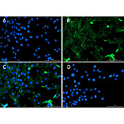 Anti-Smad1 (RABBIT) Antibody