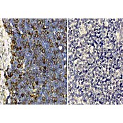 Anti-TRANSFERRIN (Human Serum) (RABBIT) Antibody