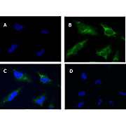 Anti-SQSTM1/p62 (RABBIT) Antibody