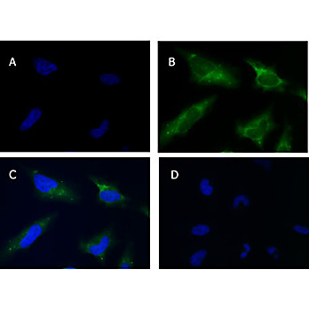 Anti-SQSTM1/p62 (RABBIT) Antibody