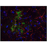 Anti-Beta Amyloid (RABBIT) Antibody