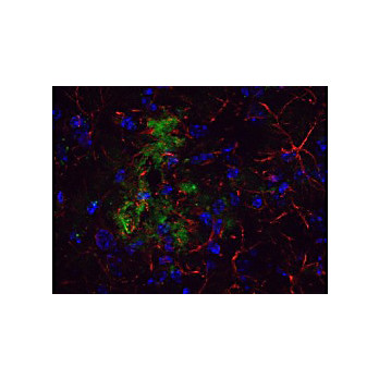 Anti-Beta Amyloid (RABBIT) Antibody