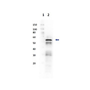 Anti-HEXOKINASE (Yeast) (RABBIT) Antibody