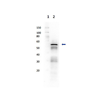 Anti-HEXOKINASE (Yeast) (RABBIT) Antibody