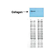 Anti-Collagen Type I (RABBIT) Antibody Peroxidase Conjugated