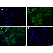 Anti-PINK1 truncated (RABBIT) Antibody