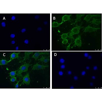Anti-PINK1 truncated (RABBIT) Antibody