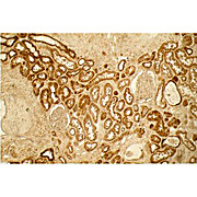 Anti-Collagen Type I (RABBIT) Antibody