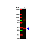 Anti-L-ASPARAGINASE (RABBIT) Antibody