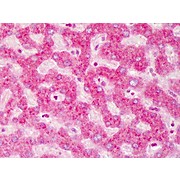 Anti-ABCB5 (RABBIT) Antibod