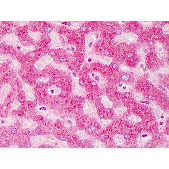 Anti-ABCB5 (RABBIT) Antibod