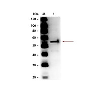 Anti-ALDEHYDE DEHYDROGENASE (Yeast) (RABBIT) Antibody Peroxidase Conjugated