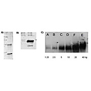Anti-Lysine Acetylated (AcK) (RABBIT) Antibody
