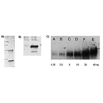 Anti-Lysine Acetylated (AcK) (RABBIT) Antibody