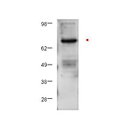 Anti-Protein Kinase C beta (RABBIT) Antibody