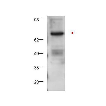 Anti-Protein Kinase C beta (RABBIT) Antibody