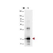 Anti-Human IL-33 (RABBIT) Antibody