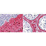 Anti-Collagen Type III (RABBIT) Antibody Peroxidase Conjugated