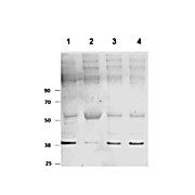 Anti-PKM2 (RABBIT) Antibody