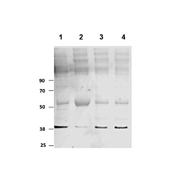 Anti-PKM2 (RABBIT) Antibody