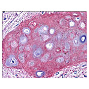 Anti-Collagen Type II (RABBIT) Antibody