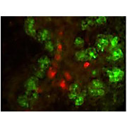 Anti-ELASTASE (RABBIT) Antibody