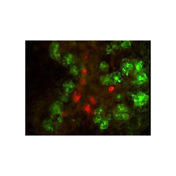 Anti-ELASTASE (RABBIT) Antibody