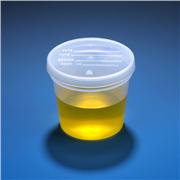 5 oz Specimen Container
