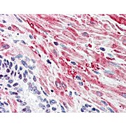 Anti-Muscle Glycogen Synthase pS641 (RABBIT) Antibody