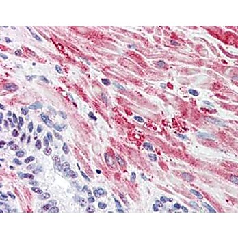 Anti-Muscle Glycogen Synthase pS641 (RABBIT) Antibody