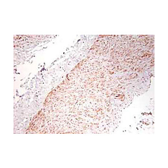 Anti-Human TNF-a (RABBIT) Antibody