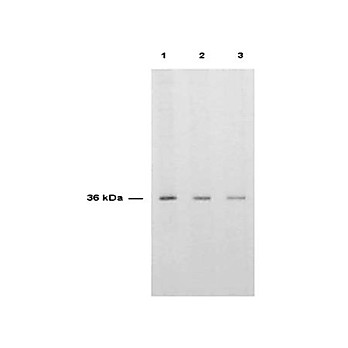 Anti-THYMIDYLATE SYNTHASE (SHEEP) Antibody
