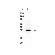 Anti-MUTAROTASE (Porcine Kidney) (RABBIT) Antibody Biotin Conjugated
