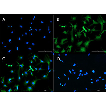 Anti-SLC40A1 (RABBIT) Antibody