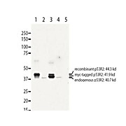 Anti-Human RRM2B/p53R2 (RABBIT) Antibody