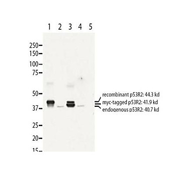 Anti-Human RRM2B/p53R2 (RABBIT) Antibody