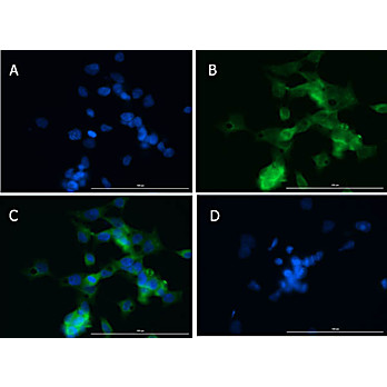 Anti-MMP2 (RABBIT) Antibody