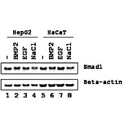 SMAD1 Antibody hu