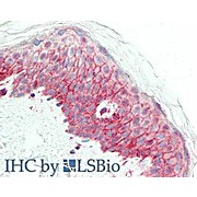 Anti-NCOA3 (RABBIT) Antibody